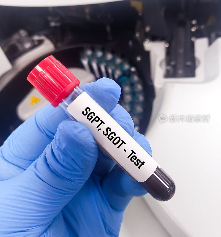 抽血进行ALT (SGPT)、AST (SGOT)检测、肝功能检测。
